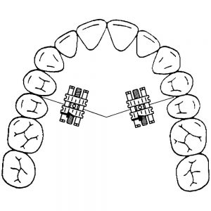 ECW1008