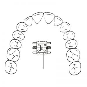 ECS2498-2